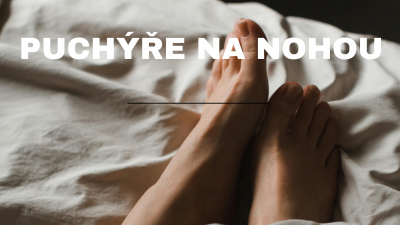 Puchiere na nohách: Nepríjemný sprievodný jav pre mnohých z nás | ARNO-obuv.sk - obuv s tradíciou